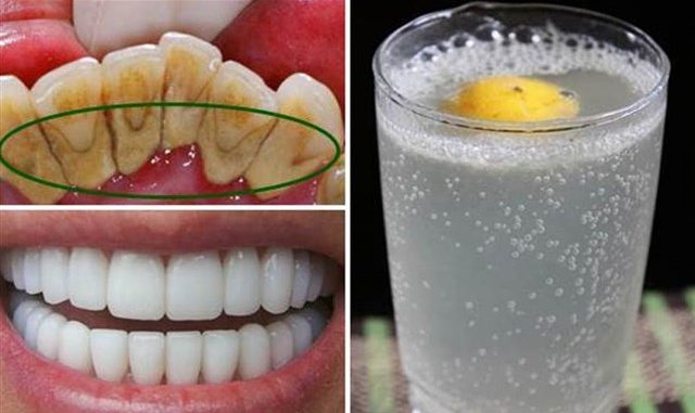 This Mouthwash Removes Plaque From Teeth In 2 Minutes