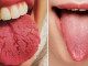 Find Out What Your Tongue Is Trying To Tell You