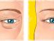 Natural Remedy for Sagging Eyelids