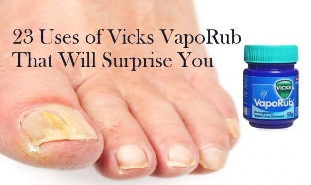 Uses of Vicks VapoRub