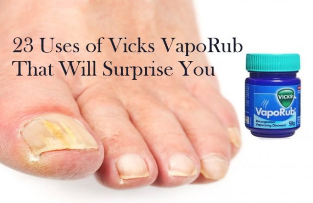 Uses of Vicks VapoRub