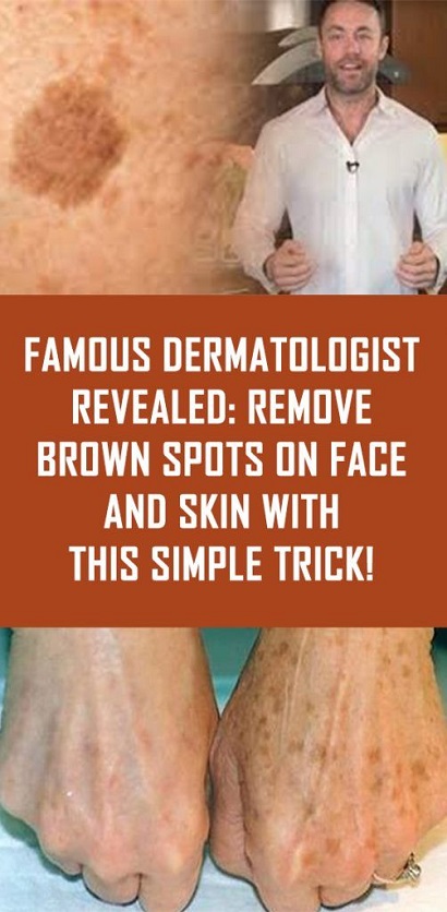 Remove Brown Spots