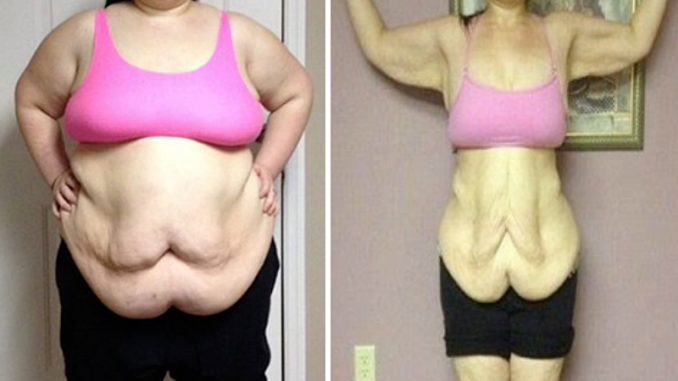 73e038d7dae5f1ec7f940059ed8f0915 OLD GRANDMAS FORMULA I LOST AROUND 700 POUNDS USING MY GRANDMAS 4 INGREDIENT DRINK THAT CAN MELT BELLY FAT OVERNIGHT