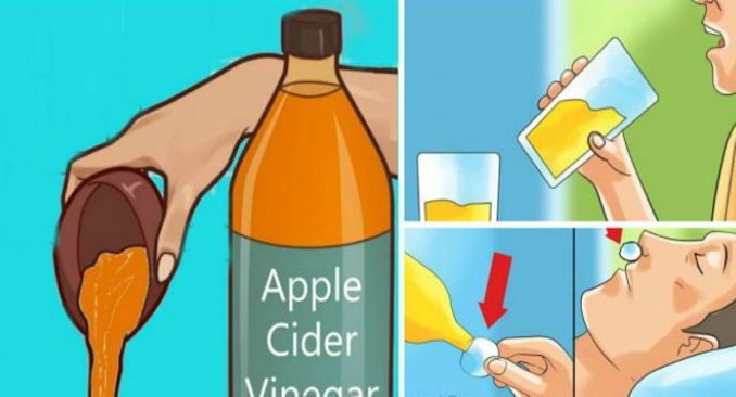 Apple Cider Vinegar