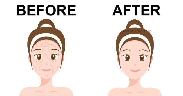Eliminate All Wrinkles Eliminate All Wrinkles