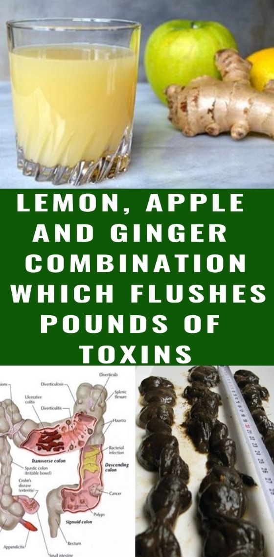 Lemon, Apple and Ginger Combination Which Flushes Pounds of Toxins 1