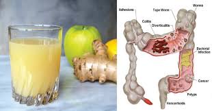 Lemon, Apple and Ginger Combination Which Flushes Pounds of Toxins