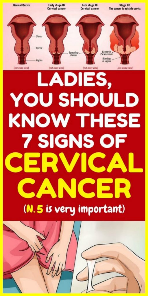 You-should-not-ignore-this-10-signs-of-cervical-cancer