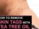 How To Remove Skin Tags With Tea Tree Oil?