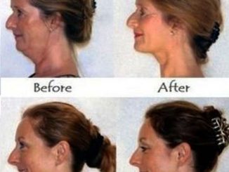 FORGET BOTOX: HERE’S HOW TO STRENGTHEN SAGGY CHEEKS, ELIMINATE DOUBLE CHIN AND LOOK YEARS YOUNGER NATURALLY