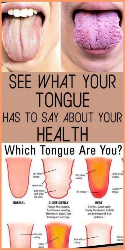 WHAT YOUR TONGUE IS TRYING TO TELL YOU ABOUT YOUR HEALTH