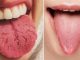 WHAT YOUR TONGUE IS TRYING TO TELL YOU ABOUT YOUR HEALTH