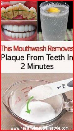 This-Mouthwash-Removes-Plaque-From-Teeth-In-2-Minutes-1