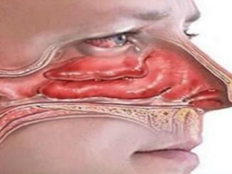 THIS SIMPLE REMEDY WILL GET RID OF ALL THE EXCESS PHLEGM FROM YOUR LUNGS AND THROAT