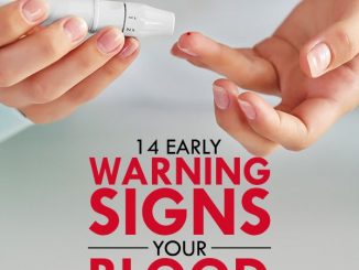 14 Early Warning Signs Your Blood Sugar is SUPER High (Eat These Foods to REVERSE it)
