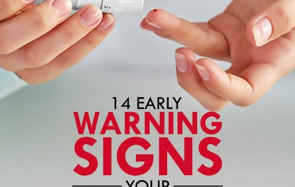 14 Early Warning Signs Your Blood Sugar is SUPER High (Eat These Foods to REVERSE it)