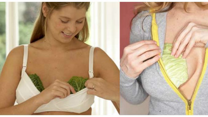 Women Are Putting Cabbage Leaves On Their Breast, Reason Behind It Will Make You Happy Women Are Putting Cabbage Leaves On Their Breast, Reason Behind It Will Make You Happy