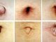 THIS IS WHAT YOUR NAVEL SHAPE TELLS ABOUT YOUR HEALTH AND BODY – A MUST READ!
