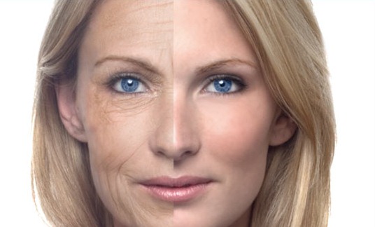 Home Remedies To Get Rid Of Wrinkles On The Face Naturallyq Home Remedies To Get Rid Of Wrinkles On The Face Naturally