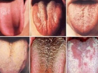 PAY CLOSE ATTENTION TO YOUR TONGUE, IT MIGHT BE SHOWING YOU SIGNS OF CERTAIN HEALTH PROBLEMS.