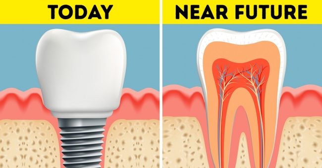 Scientists Found a Way to Regrow Teeth in 2 Months