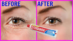Home Remedy To Erase All Aging Signs From Your Face Home Remedy To Erase All Aging Signs From Your Face