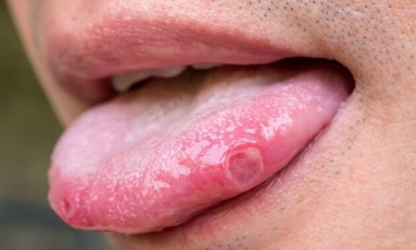 5 Warning Signs of Vitamin B12 Deficiency You Should Never Ignore 5 Warning Signs of Vitamin B12 Deficiency You Should Never Ignore