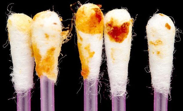 Your Earwax Can Tell How Healthy You Are. What Color Is Yours?