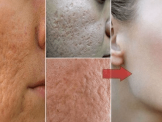 How To Make Pores Disappear With Only 1 Ingredient Naturally