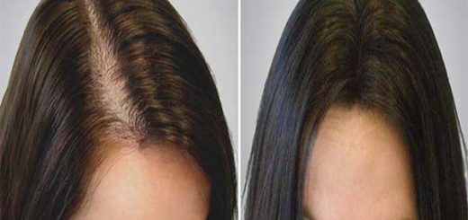 Mix These 3 Ingredients To Regrow Thick, Strong Hair In No Time
