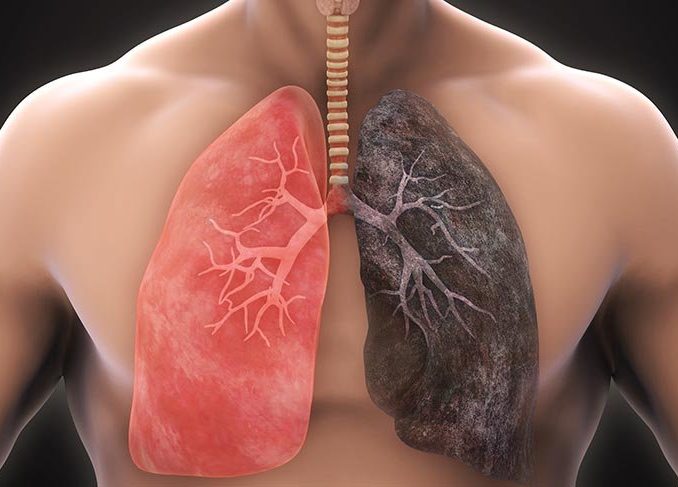 1 Fincan… Akciğerler ve Solunum Sistemi İçin Çay!