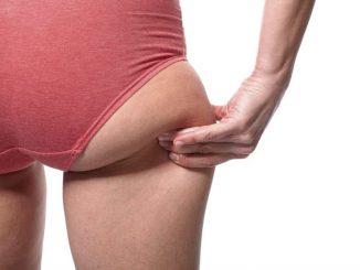 How to get rid of saddlebags