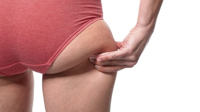 How to get rid of saddlebags