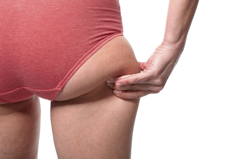 How to get rid of saddlebags